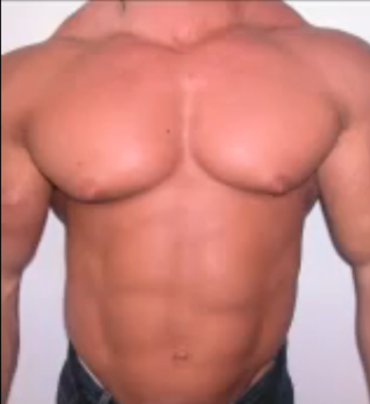 Side effects of taking nolvadex without steroids Side effects of taking nolvadex without steroids