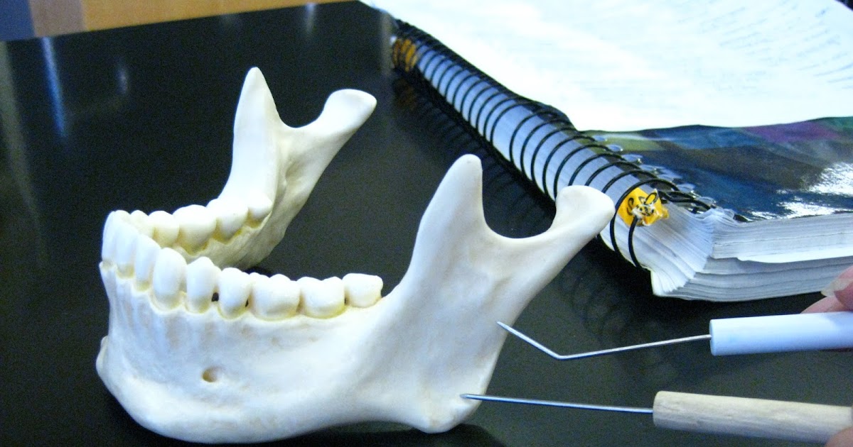 Boned: Human Skull - ramus (of mandible)