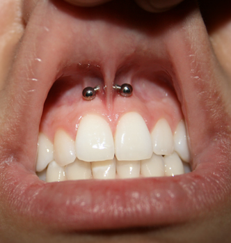 Piercing para Homens Piercing para Homens Smile