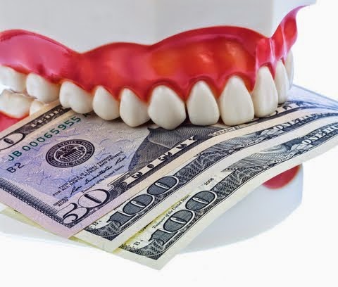 coût des implants dentaires