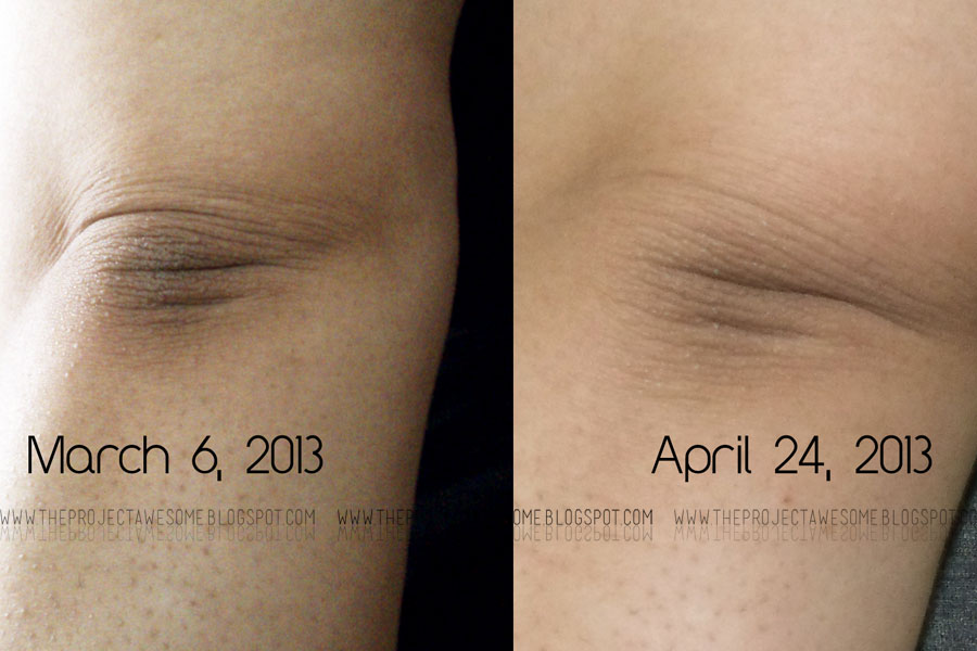 The Project Awesome Product Review Yoko Knee and Elbow Moisturizing