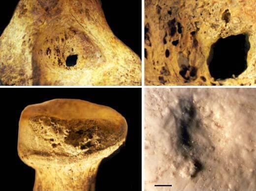 Kennewick man and the native american graves protection and repatriation act nagpra