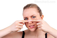 Tips For Blackheads