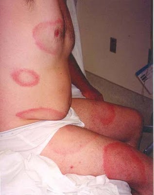 Dog Nipple Red And Swollen Dog Nipple Red And Swollen