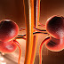 206 Stones Removed From Man’s Kidney