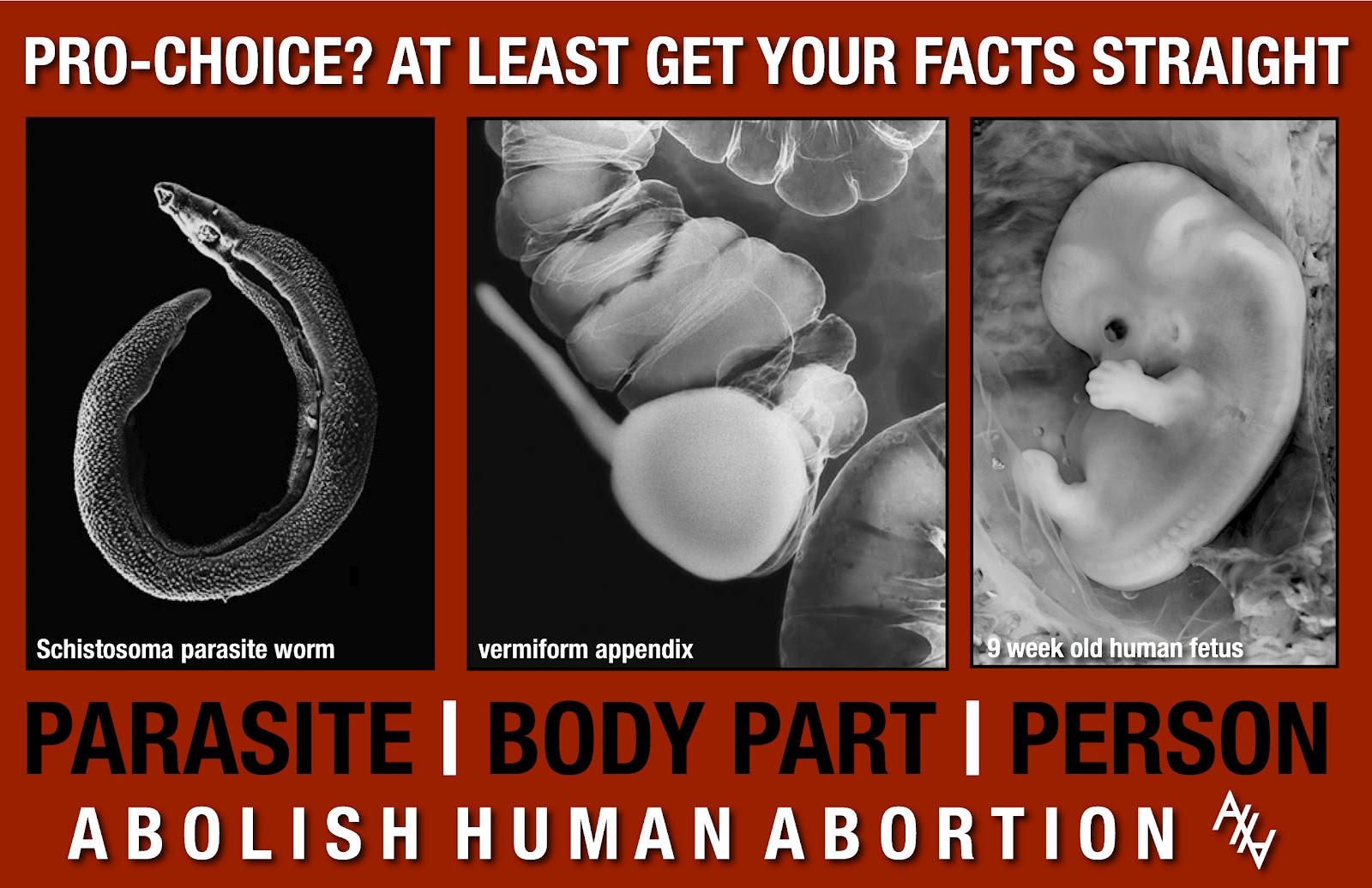 Persuasive Essay (Abortion)