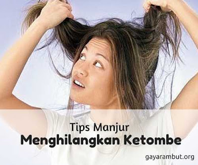 Tips menghilangkan ketombe yang parah Tips menghilangkan ketombe yang parah95478