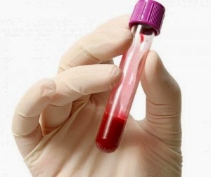 Bagaimana Anemia dapat dikesan? Bagaimana Anemia dapat dikesan?