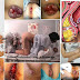Obat Wasir Parah Bengkak Nyeri Luar Biasa thumbnail