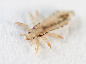 Pulitissima I Pidocchi