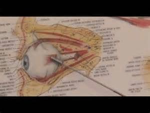 Some Considerations When Performing Eye Surgery Los Angeles Generally in the wake of doing eye surgery los angeles, we will additionally be given the alternative to counsel. It is exceptionally valuable to the visual conclusion we need. Obviously this is carried out at a certain time with the goal that it can furnish better comes about. Actually, a few specialists prompted us to give an extremely exceptional timetable for this counsel. Additionally, it is to offer impact to the state of our eyes after surgery. Some individuals who have done this eye surgery conference will normally just when she felt torment in certain parts. This is not a huge issue, yet we might as well counsel when our eyes are likewise under typical conditions.