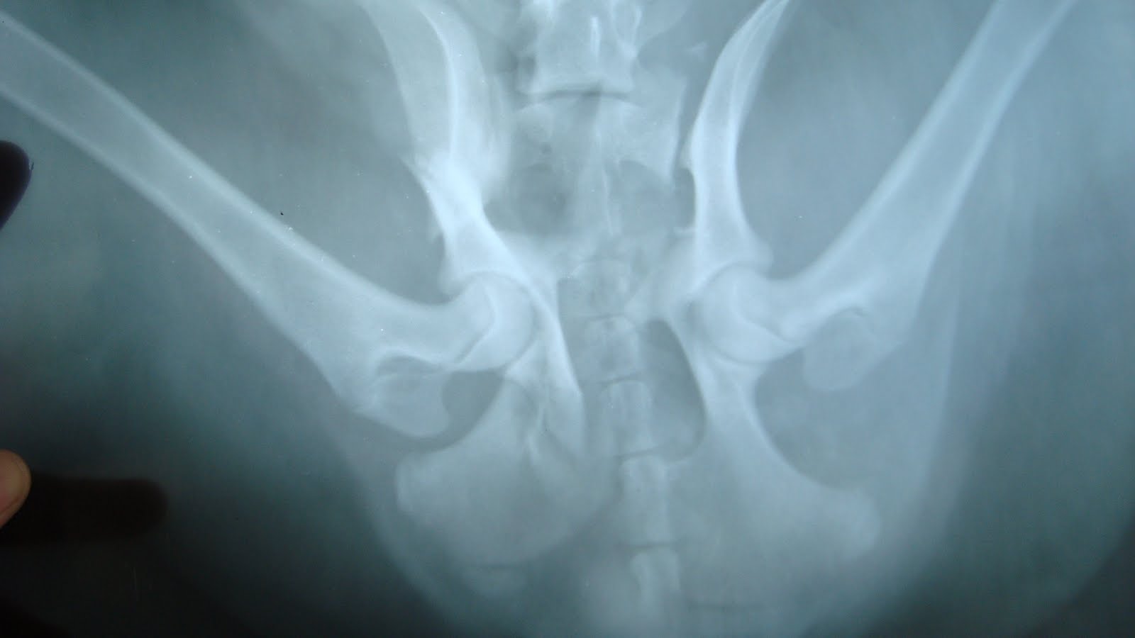 pelvic fracture ct scan