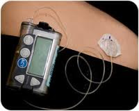 more questions regarding Insulin Pumps