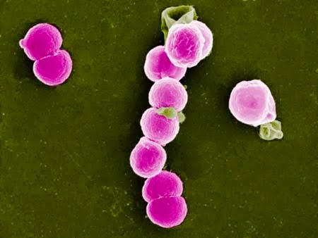obat alami penis keluar nanah, Mengobati Kemaluan Keluar Nanah, obat keluar nanah yang alami