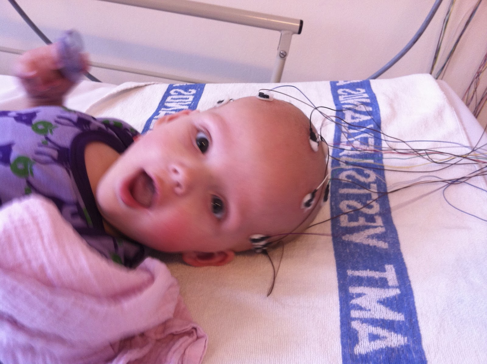 9) Eye Rolling turning out to be Seizures Sotos is Beautiful