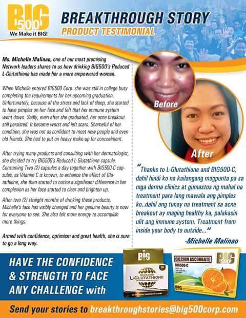 Jenefer Castillo Home Remedies Para Mag Dry Ang Pimples Acne Overnight