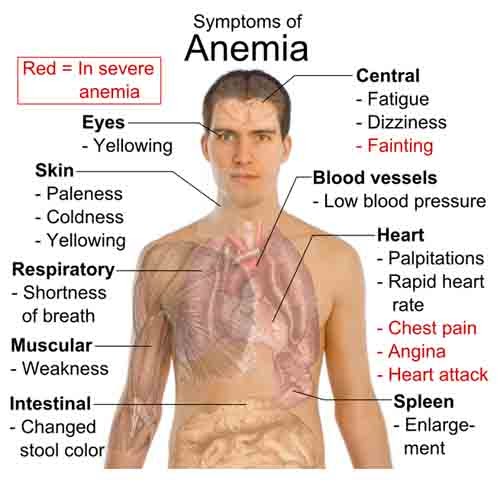 About Anemia Symptoms of Anemia