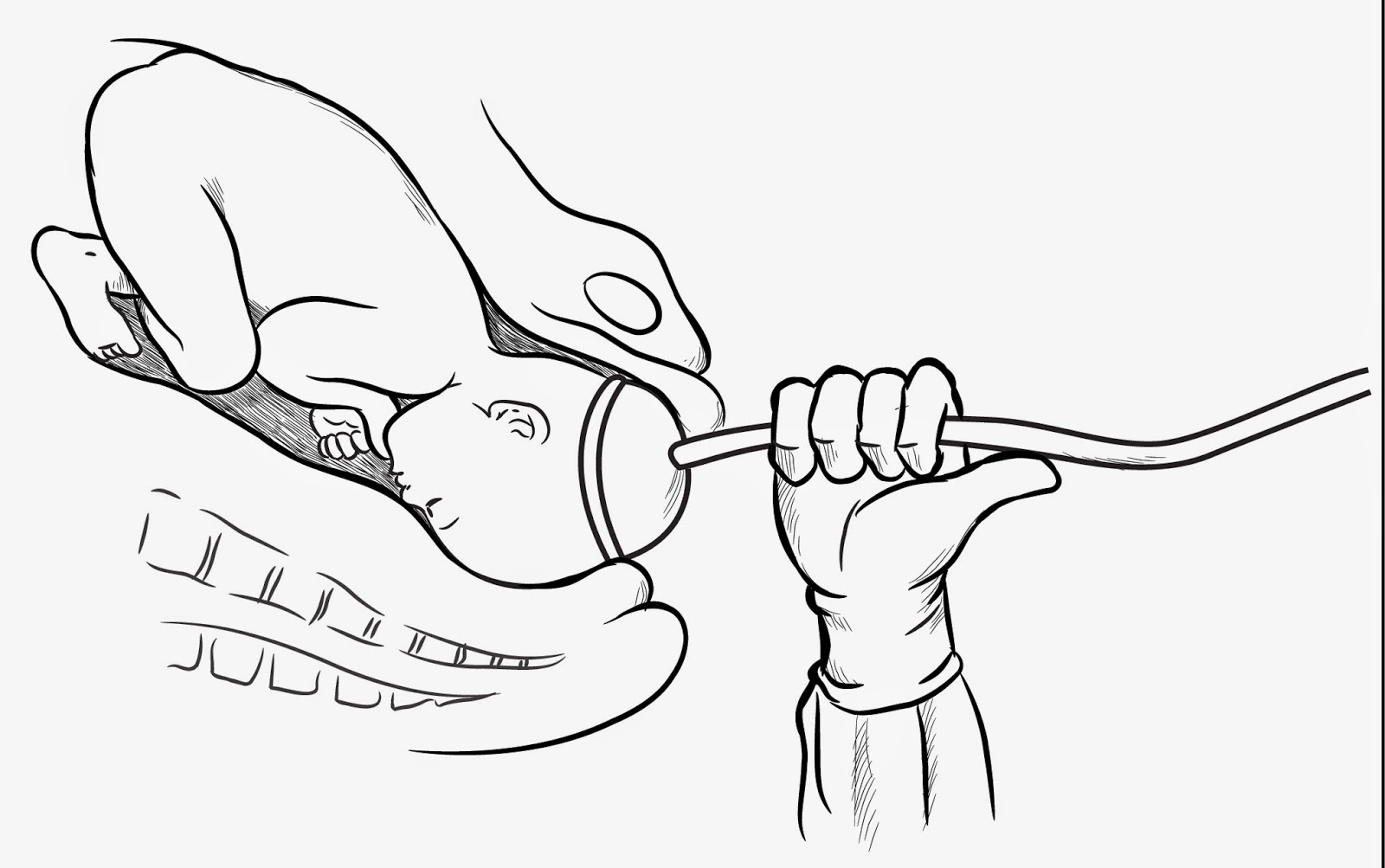 Asuhan Keperawatan Perdarahan Post Partum Pdf