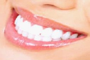 Teeth in an Hour Houston Teeth in an Hour Houston