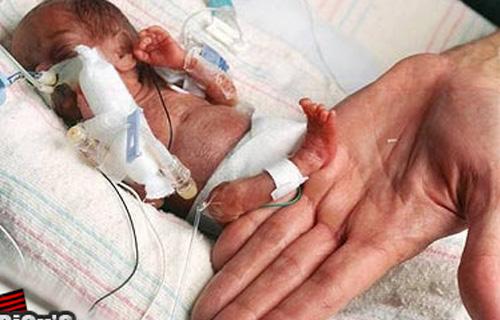 Menor bebê prematuro do país terá alta amanhã | Prematuridade.com Menor bebê prematuro do país terá alta amanhã | Prematuridade.com