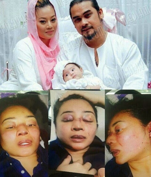 Awie Mengaku Dipanggil Polis Isu Isteri Dipukul Awie Mengaku Dipanggil Polis Isu Isteri Dipukul