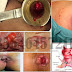 Antihemoroid Non Kimia Farma thumbnail