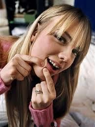 Ακμή: ο εφιάλτης των εφήβων! Ακμή: ο εφιάλτης των εφήβων!