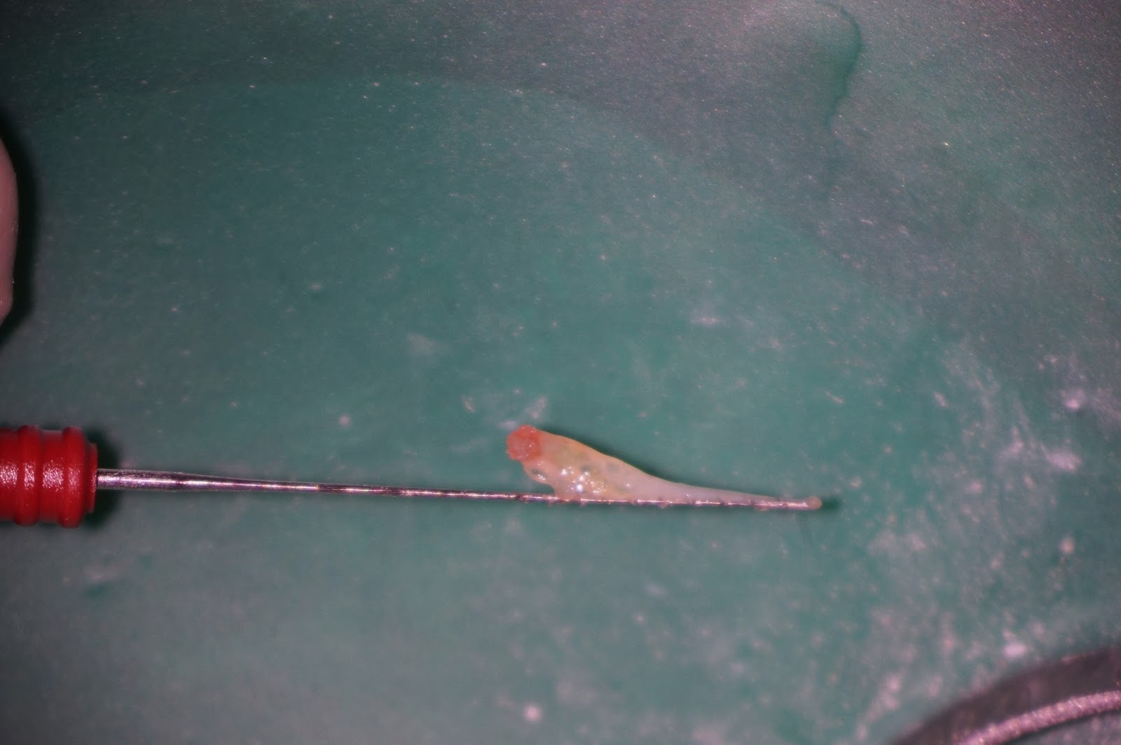 The Endo Blog December 2015