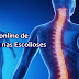 Material: Curso online de Pilates nas Escolioses