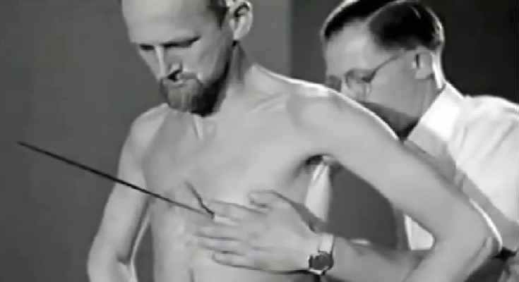 Mirin Dajo: Ο άνθρωπος που άφησε άφωνη την ιατρική κοινότητα Mirin Dajo: Ο άνθρωπος που άφησε άφωνη την ιατρική κοινότητα