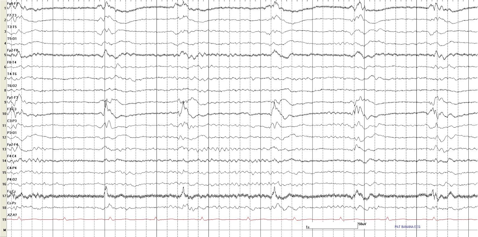 EEG Reviewer EEG No. 53