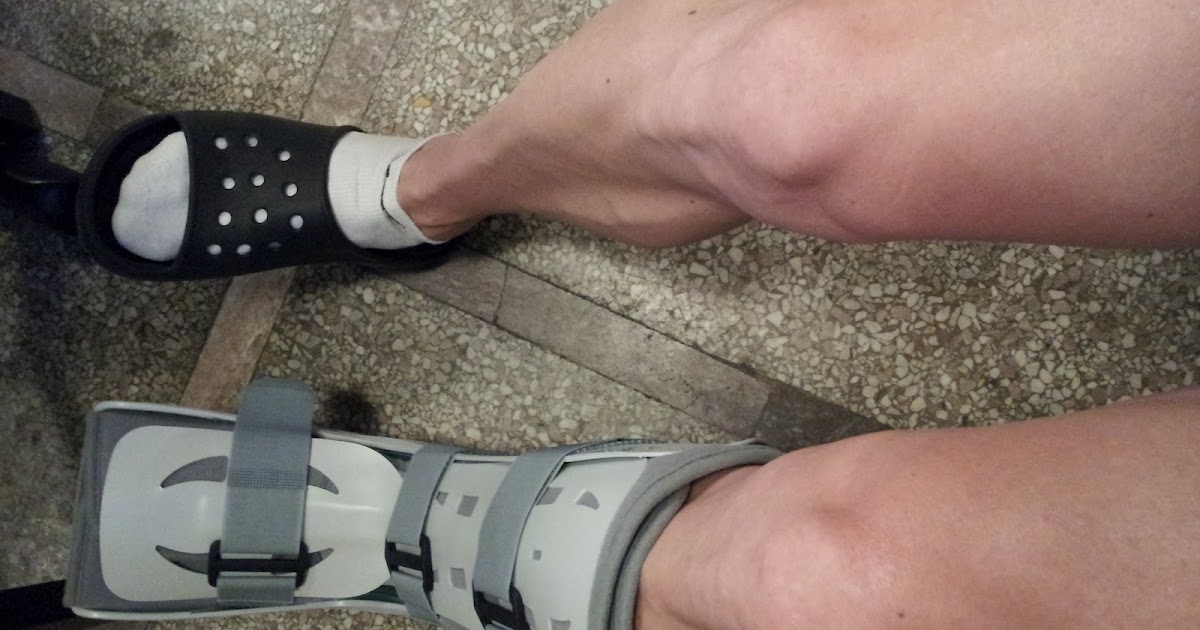 Fracture Boot Fracture Treatment