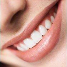 Tips Cara Ampuh Agar Gigi Putih
