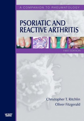 Psoriatic and Reactive Arthritis: A Companion to Rheumatology, 1e 