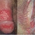 Jual Obat Sipilis 3-5 Hari Sembuh thumbnail