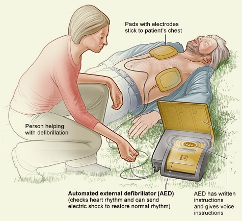 United States External Defibrillators Market United States External Defibrillators Market