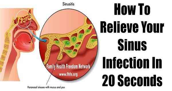 HOW TO RELIEVE YOUR SINUS INFECTION IN 20 SECONDS | Home ...