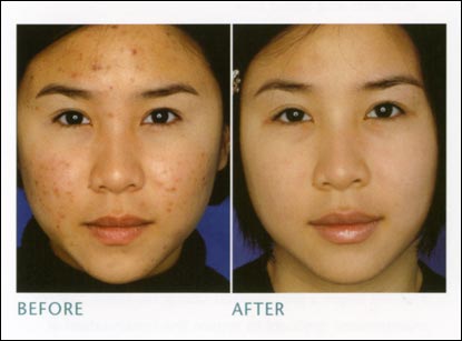 RosieDolly*: SKIN CARE BOOT CAMP! RosieDolly*: SKIN CARE BOOT CAMP!