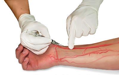 Exame de sangue gasometria arterial