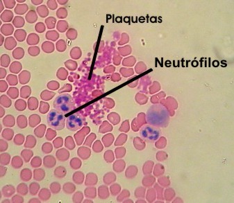 HEMATIES SANGRE hematies sangre: