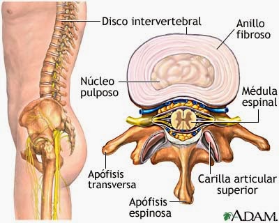 Las complicaciones de la hernia del departamento de pecho