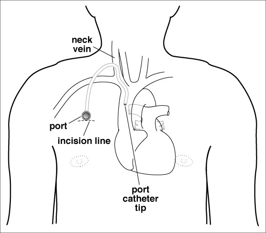 port placement