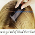 How to get rid of Head Lice Fast