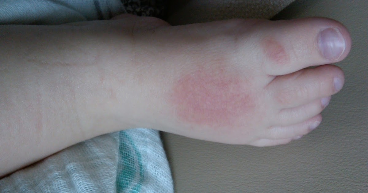 The Xander Apollo Blog Rug Burn