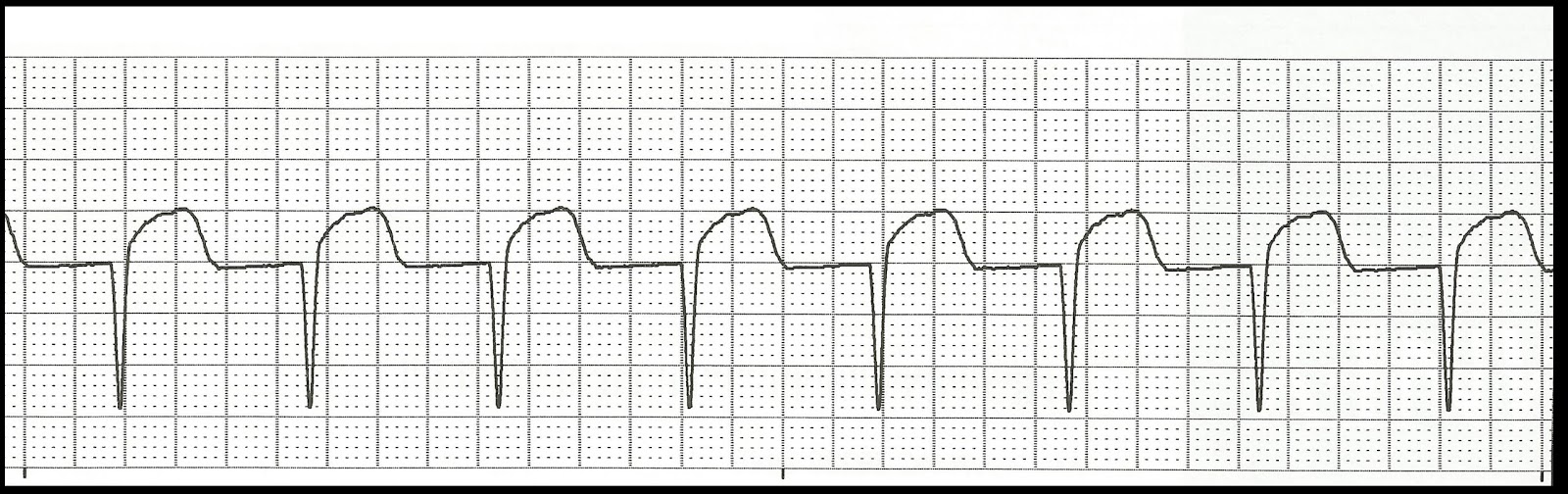 Ecg pratice strips ekg Ecg pratice strips ekg