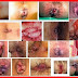 Harga Obat Ambeyen Dalam thumbnail