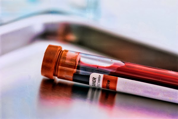 Bastonetes baixos no exame de sangue