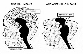 Blessed By Grace Morris My Unicorn Baby blessed by grace morris blogger