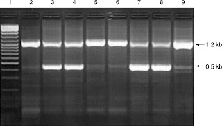 Agarose gel gel electrophoresis