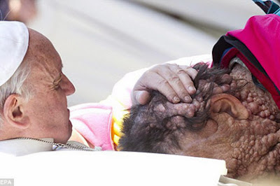 Pope Francis embraces a member of his congregation suffering from neuronal tumors at the Vatican (Photo: EPA) Pope Francis embraces a member of his congregation suffering from neuronal tumors at the Vatican (Photo: EPA)